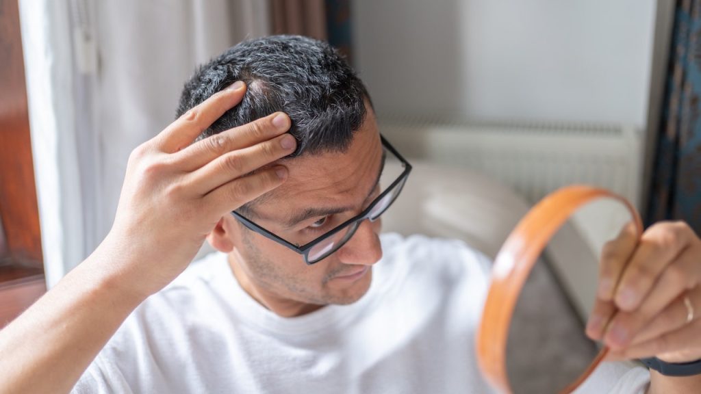 New hair loss treatment shows significant improvement over placebo